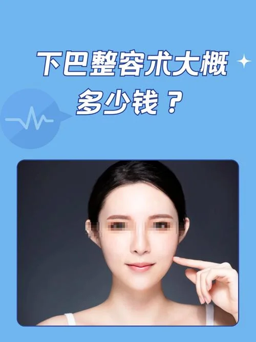 下巴假体多少钱-下巴假体价格参考
