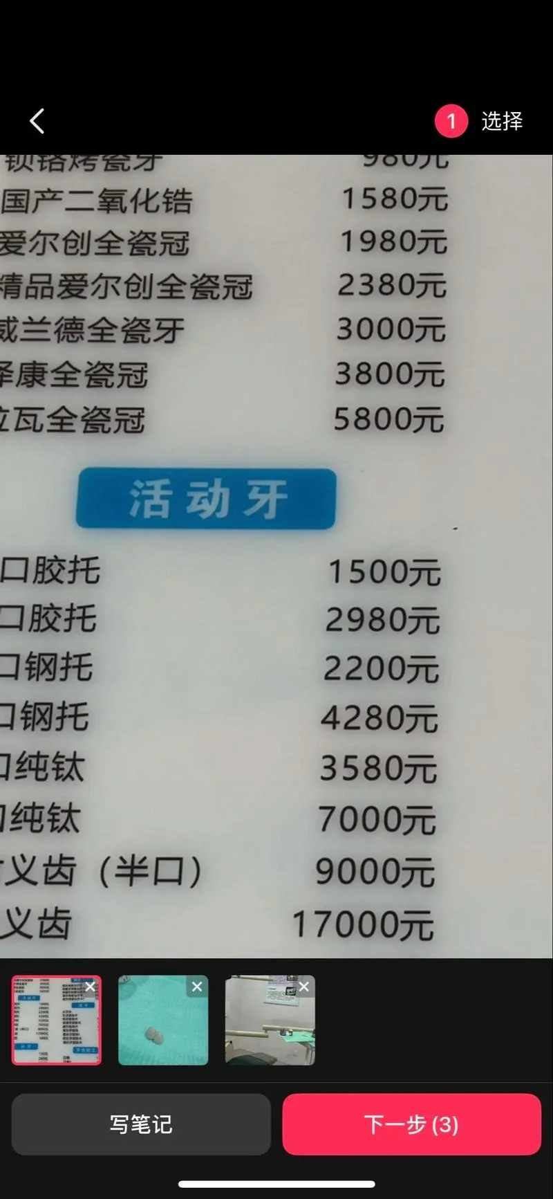 隐形牙套需要多少钱_1