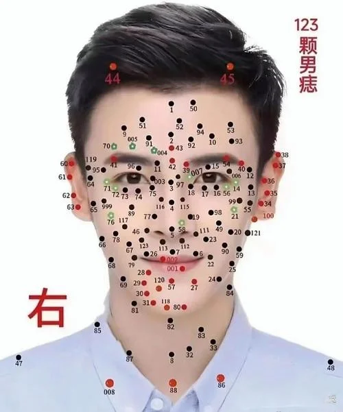 脸颊有痣面相-脸颊痣面相