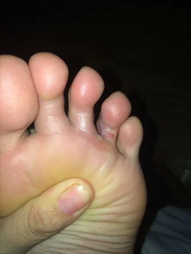 梦见脚烂了_1
