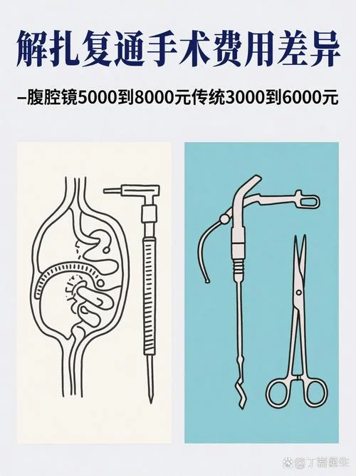 做解扎手术需要多少钱_2