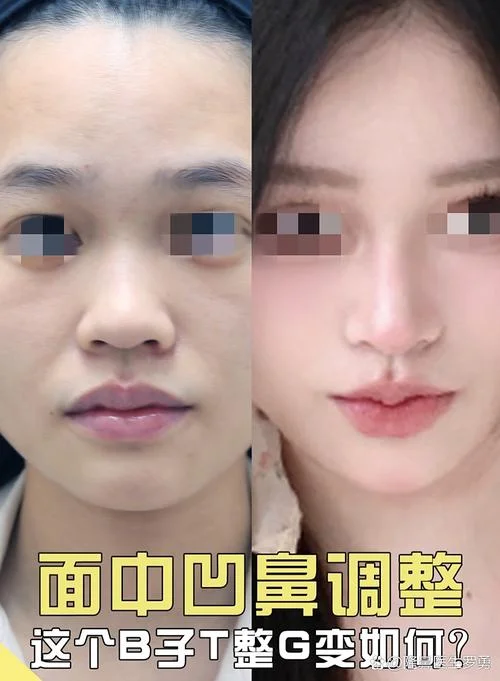鼻翼大面相女_1