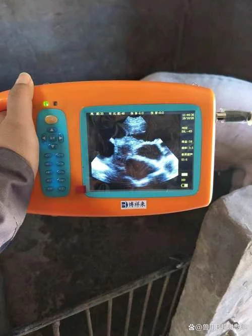 孕期b超怎么做_2