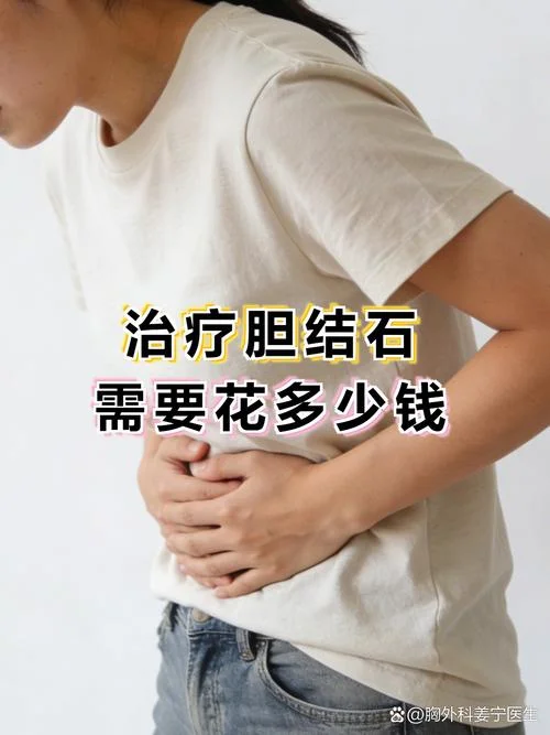 胆结石需要花多少钱_2