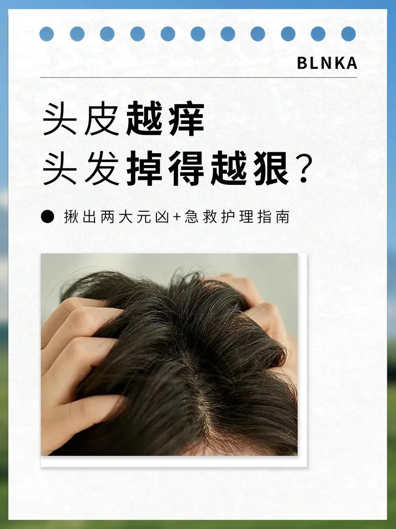 头发发毛干燥怎么办_1