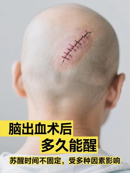 梦见头上出血是什么意思_1