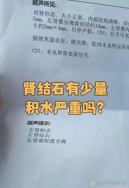如何查肾积水-查肾积水方法