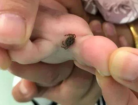 做梦梦到被虫子咬了_2