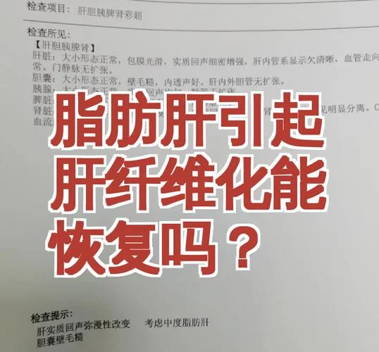 肝纤维化如何查_1
