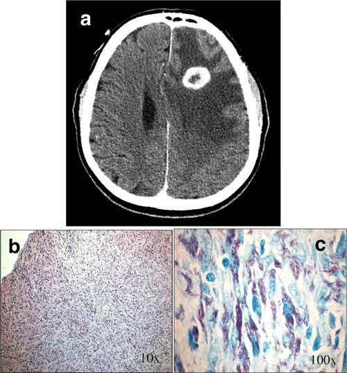 fig1是什么意思_1