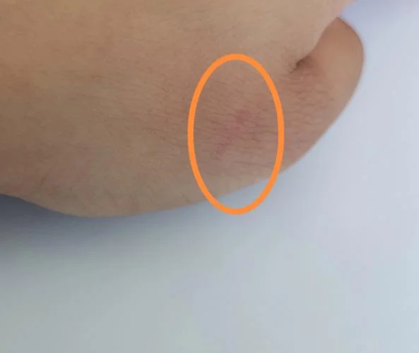梦到被狗咬手出血了是什么预兆_2
