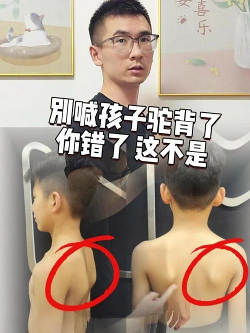 小孩肩胛骨突出怎么办_1