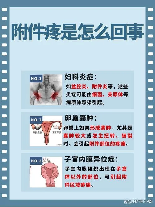 什么是附件炎症_1