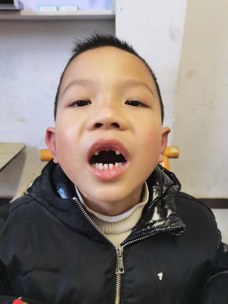 男人梦见自己孩子长牙_2