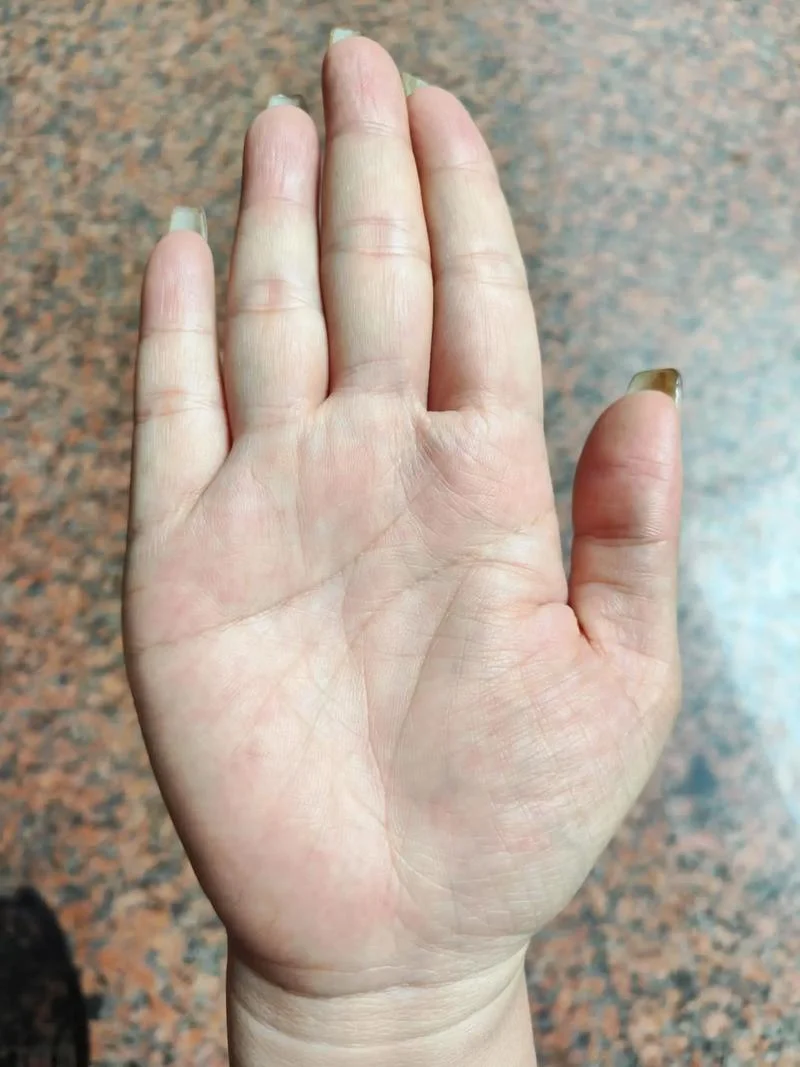 两个人手相特别像-双掌纹路如出一辙