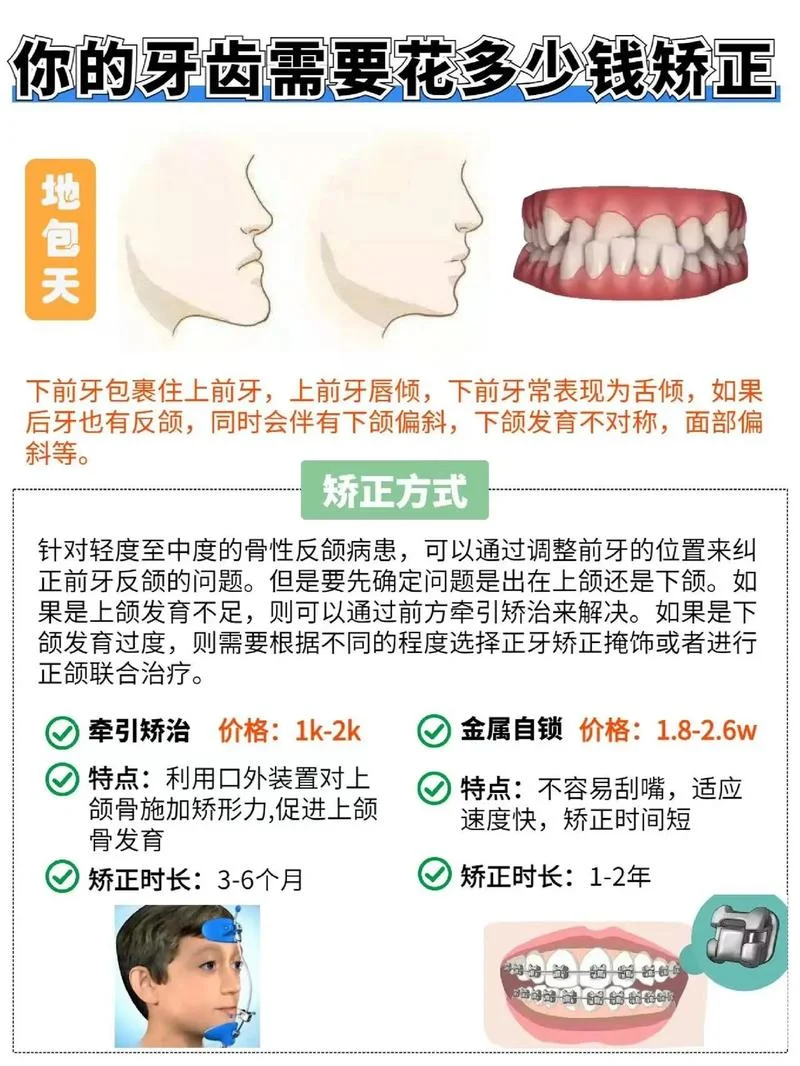 12岁牙齿矫正多少钱-十元矫正费用