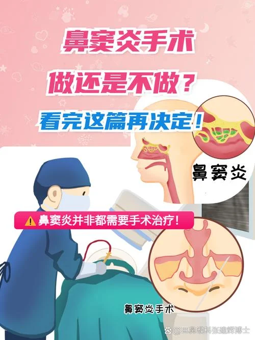 鼻窦炎手术大概多少钱_1