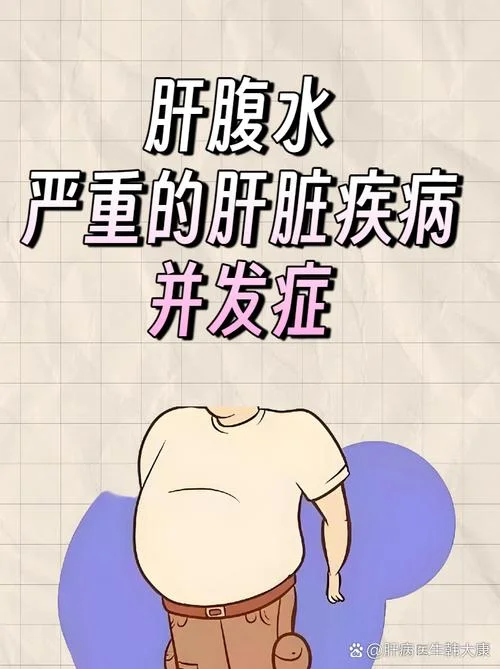 肝硬化腹水感悟_1