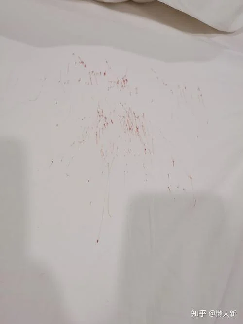 梦见床上两大片血_2