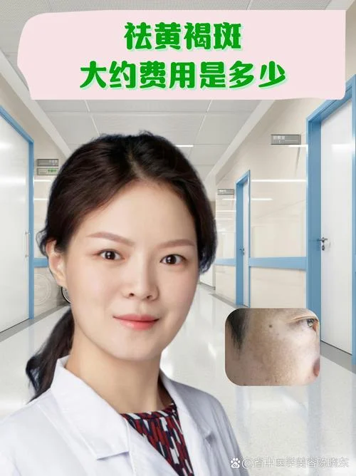 医院祛斑大约要多少钱_2