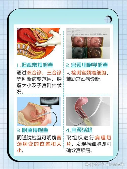 子宫内膜癌如何筛查_1