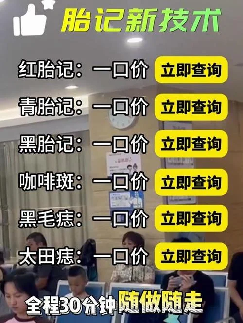 割胎记多少钱_2