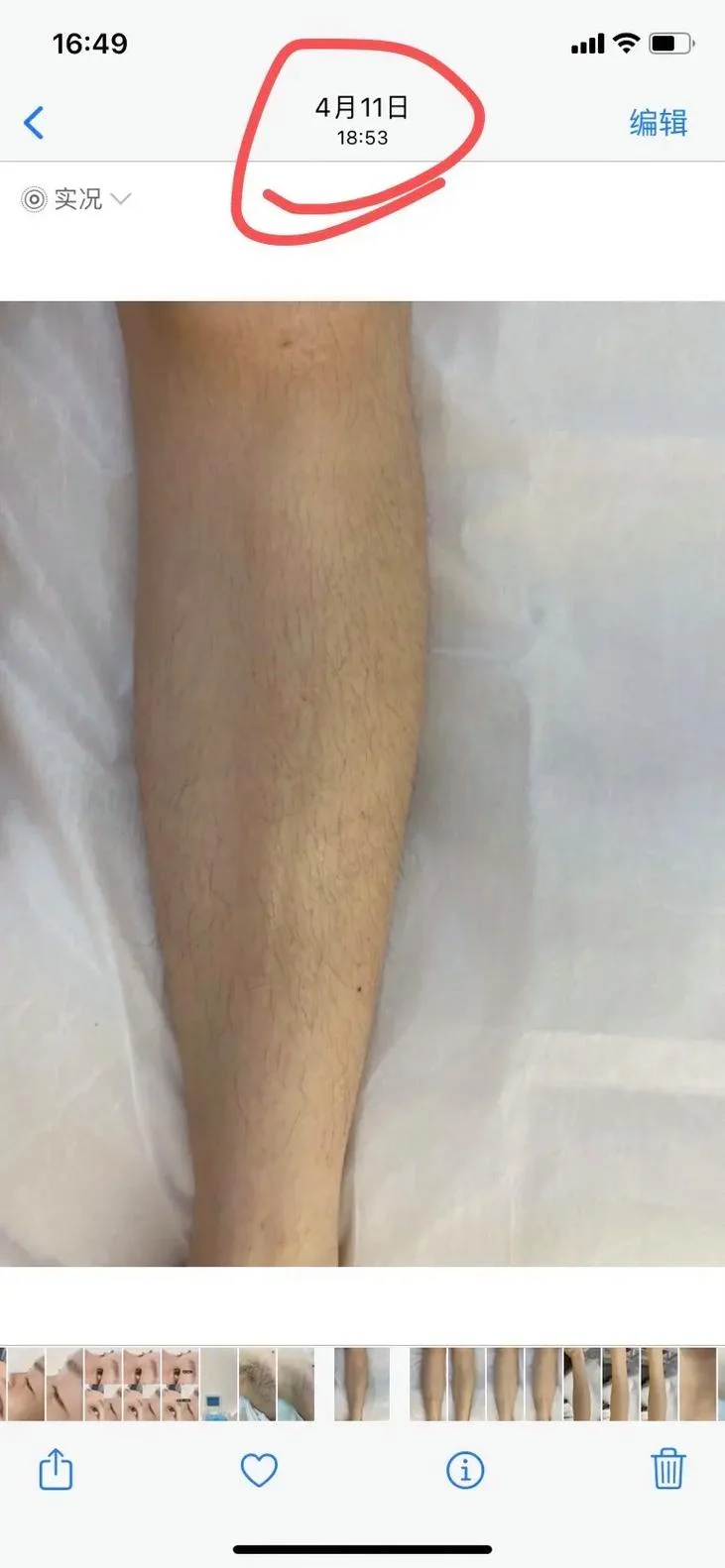 脱手毛多少钱_2