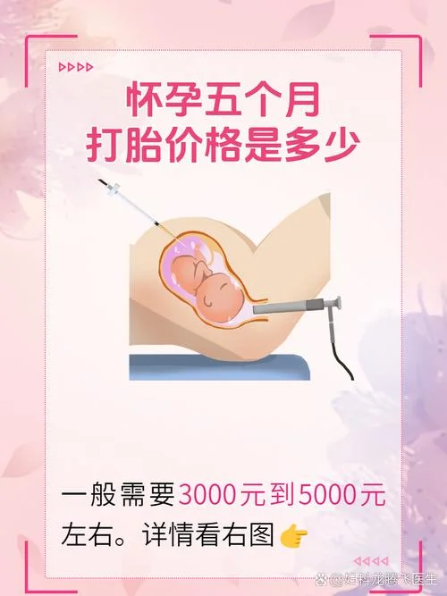 无痛人工流产多少钱啊_1