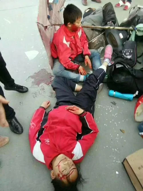 梦到别人出车祸看见血_2