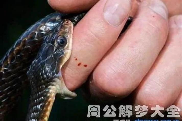 梦见被蛇咬了一口差点毒死_2