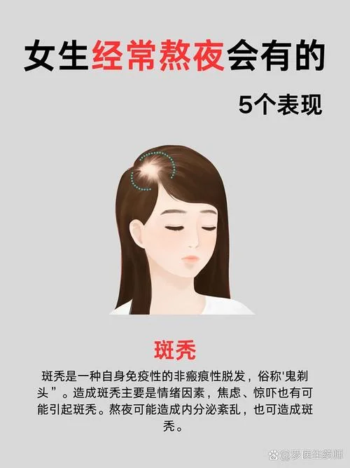 女梦见掉头发斑秃_1