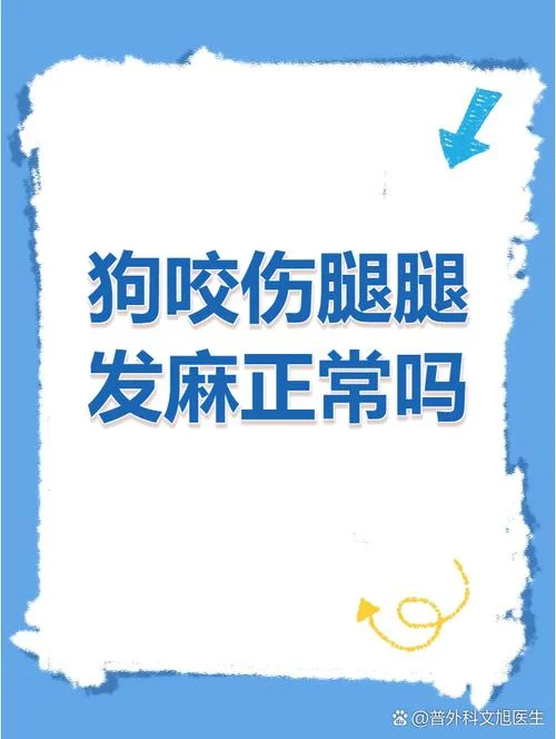 梦见被狗咬腿预示着什么_2