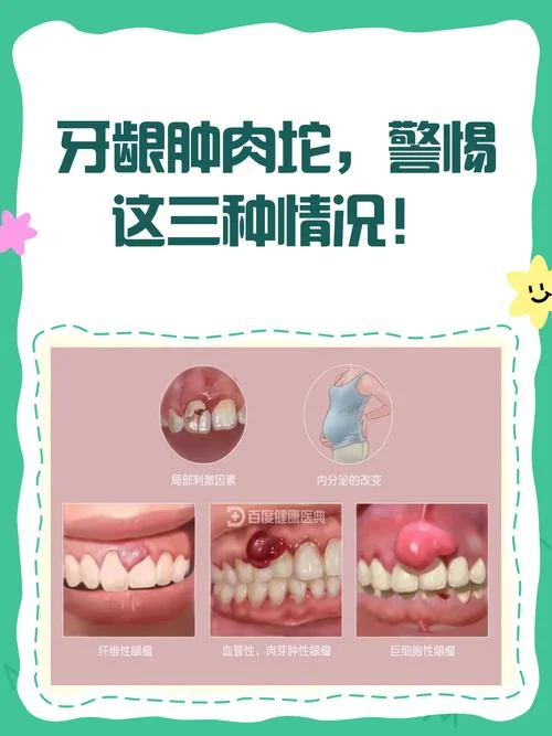 做梦梦见牙龈肿痛_1