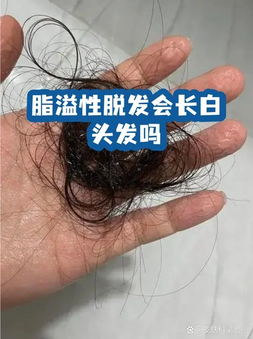 梦见头发变白并脱发_1