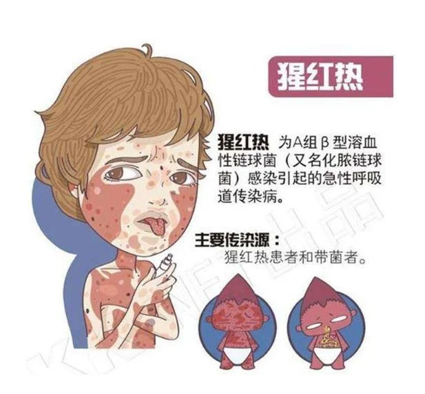 血热是一种什么病-血热病症概览