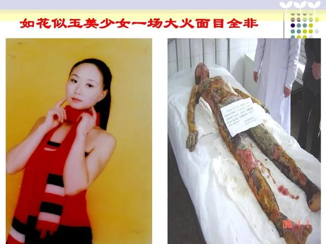 女人梦到着火自己扑灭_1