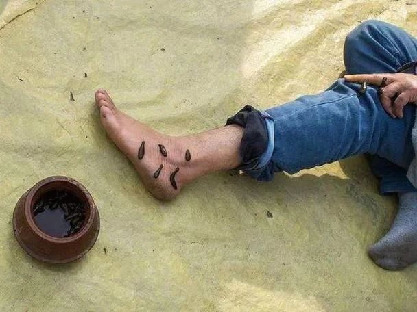 梦到踩死虫子_2