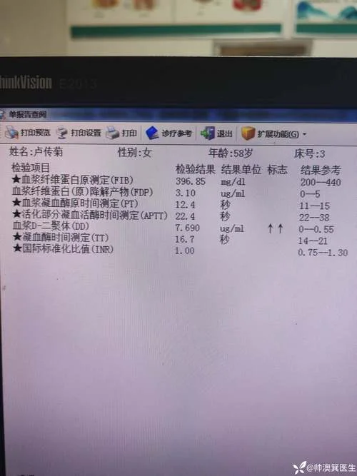 肝硬化腹水病历怎么写-肝硬化腹水病历写法