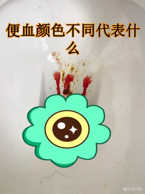 梦见很多血预示什么_1