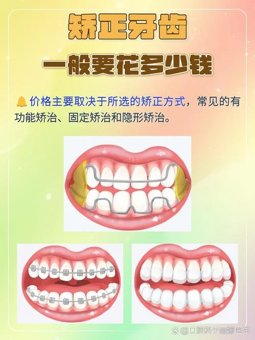 虎牙矫正大概需要多少钱_1