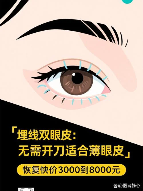 拉双眼皮要花多少钱_1