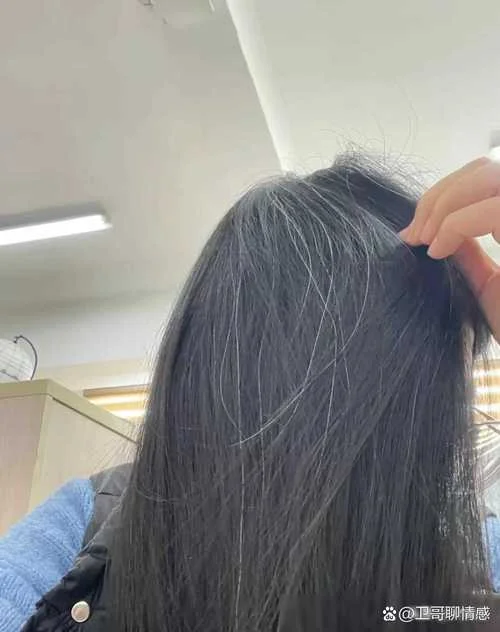 梦见好多白头发_2
