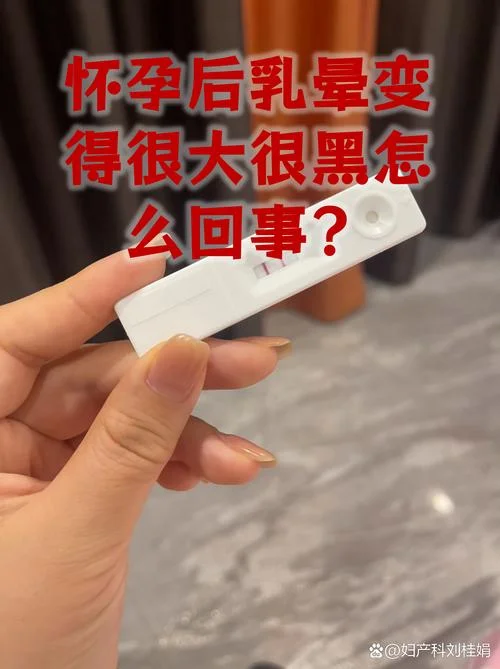 乳头周围黑怎么办-乳头周围黑须处理