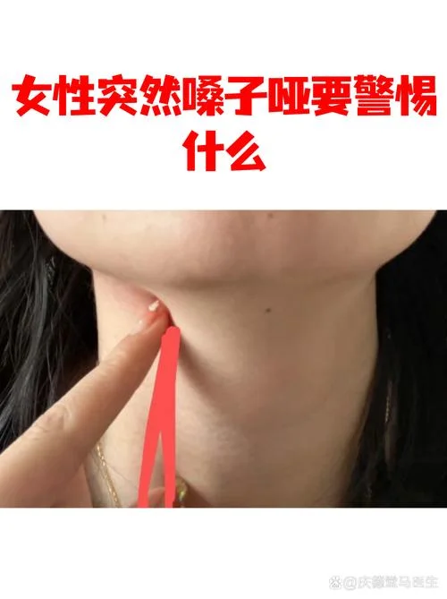 声带受损声音嘶哑怎么办-声带受损声音嘶哑怎么办