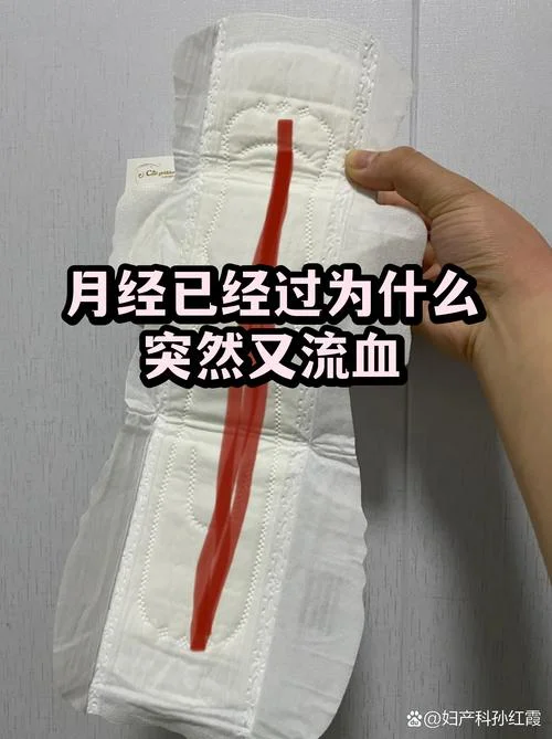 为什么排卵期会出血是怎么回事-排卵期出血成因