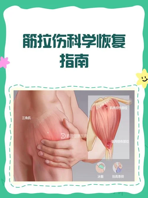 锻炼肌肉拉伤怎么办-肌肉拉伤怎么办