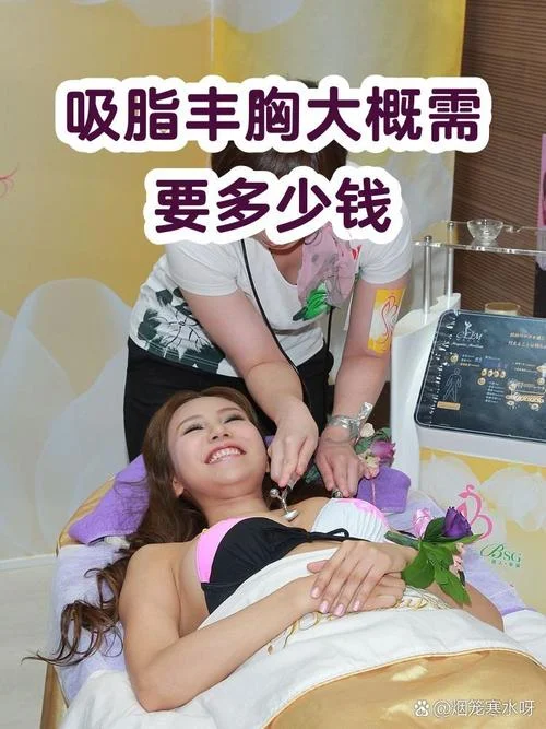 假体丰胸手术需要多少钱_1