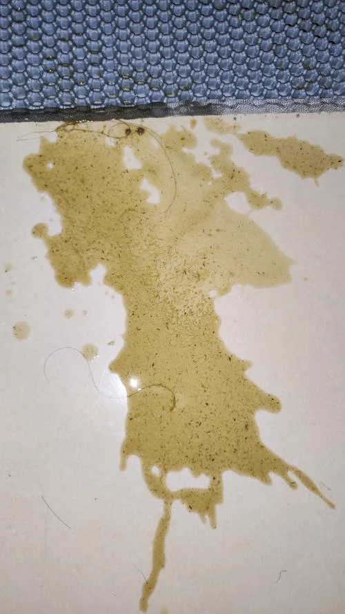 梦见嘴里吐出脏东西_1