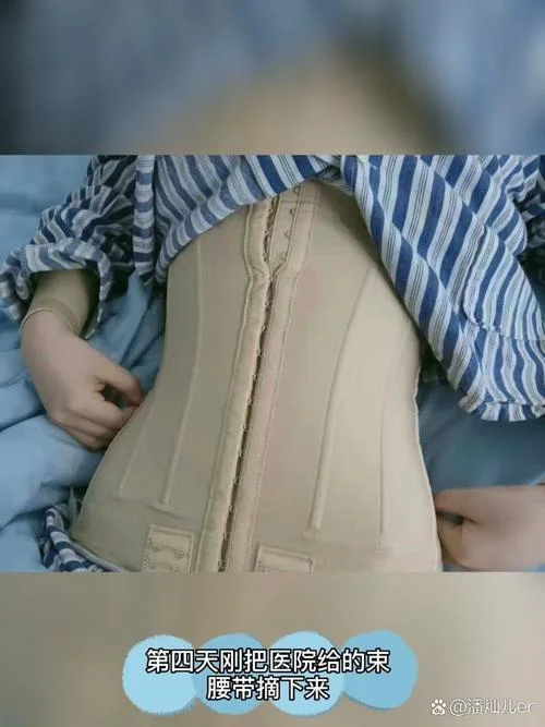 臀部整形需要多少钱_1
