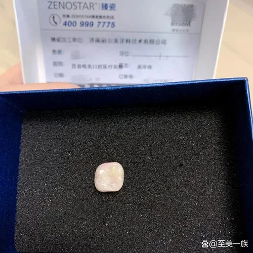 美容冠一颗大概多少钱_1